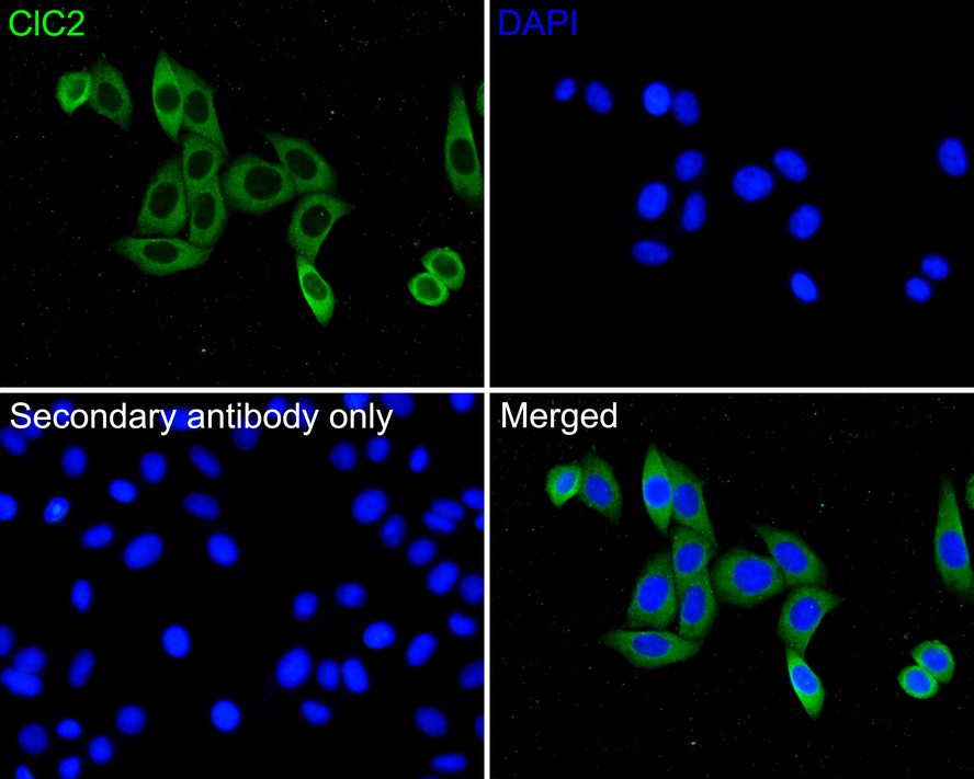Immunocytochemistry analysis of SiHa cells labeling ClC2 with Rabbit anti-ClC2 antibody (HA500243) at 1/200 dilution.<br />
<br />
Cells were fixed in 4% paraformaldehyde for 10 minutes at 37 ℃, permeabilized with 0.05% Triton X-100 in PBS for 20 minutes, and then blocked with 2% negative goat serum for 30 minutes at room temperature. Cells were then incubated with Rabbit anti-ClC2 antibody (HA500243) at 1/200 dilution in 2% negative goat serum overnight at 4 ℃. Goat Anti-Rabbit IgG H&L (iFluor™ 488, HA1121) was used as the secondary antibody at 1/1,000 dilution. PBS instead of the primary antibody was used as the secondary antibody only control. Nuclear DNA was labelled in blue with DAPI.