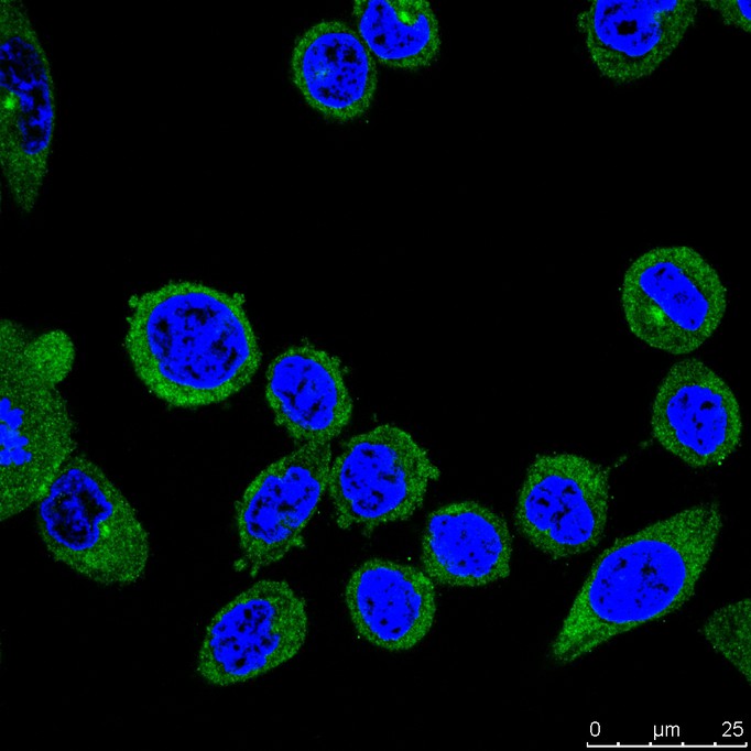 Immunocytochemistry analysis of Siha cells labeling FAM38A/PIEZO1 with Mouse anti-FAM38A/PIEZO1 antibody (M1005-2) at 1/100 dilution.<br />
<br />
Cells were fixed in 4% paraformaldehyde for 30 minutes, permeabilized with 0.1% Triton X-100 in PBS for 15 minutes, and then blocked with 2% BSA for 30 minutes at room temperature. Cells were then incubated with Mouse anti-FAM38A/PIEZO1 antibody (M1005-2) at 1/100 dilution in 2% BSA overnight at 4 ℃. Goat Anti-Mouse IgG H&L (iFluor™ 488, HA1125) was used as the secondary antibody at 1/1,000 dilution. PBS instead of the primary antibody was used as the secondary antibody only control. Nuclear DNA was labelled in blue with DAPI.