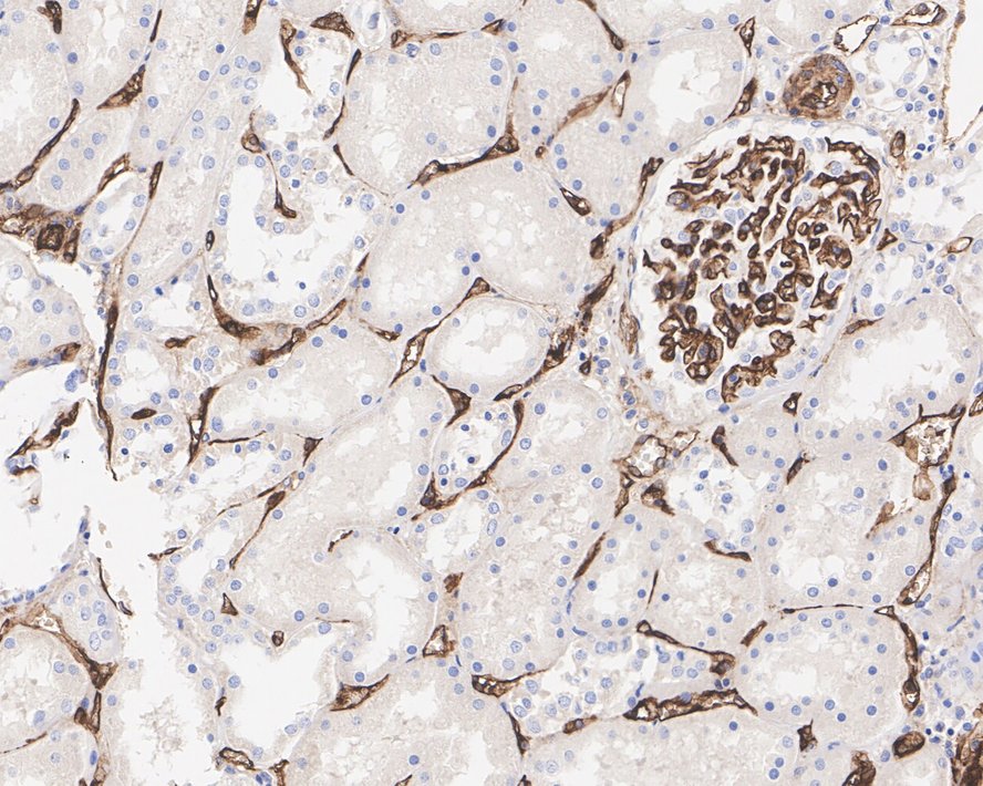 Immunohistochemical analysis of paraffin-embedded mouse kidney tissue with Rabbit anti-CD34 antibody (ET1606-11) at 1/200 dilution.<br />
<br />
The section was pre-treated using heat mediated antigen retrieval with Tris-EDTA buffer (pH 9.0) for 20 minutes. The tissues were blocked in 1% BSA for 20 minutes at room temperature, washed with ddH2O and PBS, and then probed with the primary antibody (ET1606-11) at 1/200 dilution for 1 hour at room temperature. The detection was performed using an HRP conjugated compact polymer system. DAB was used as the chromogen. Tissues were counterstained with hematoxylin and mounted with DPX.