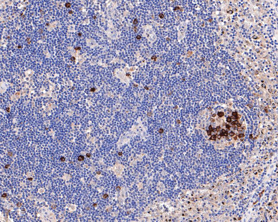 Immunohistochemical analysis of paraffin-embedded human lymph nodes tissue with Rabbit anti-Cyclin B1 antibody (ET1608-27) at 1/400 dilution.<br />
<br />
The section was pre-treated using heat mediated antigen retrieval with Tris-EDTA buffer (pH 9.0) for 20 minutes. The tissues were blocked in 1% BSA for 20 minutes at room temperature, washed with ddH2O and PBS, and then probed with the primary antibody (ET1608-27) at 1/400 dilution for 1 hour at room temperature. The detection was performed using an HRP conjugated compact polymer system. DAB was used as the chromogen. Tissues were counterstained with hematoxylin and mounted with DPX.