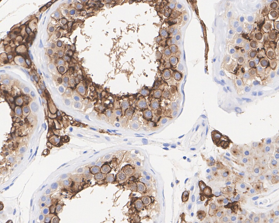 Immunohistochemical analysis of paraffin-embedded mouse kidney tissue using anti-ACE2 antibody. The section was pre-treated using heat mediated antigen retrieval with Tris-EDTA buffer (pH 8.0-8.4) for 20 minutes.The tissues were blocked in 5% BSA for 30 minutes at room temperature, washed with ddH2O and PBS, and then probed with the primary antibody (ET1611-58, 1/50) for 30 minutes at room temperature. The detection was performed using an HRP conjugated compact polymer system. DAB was used as the chromogen. Tissues were counterstained with hematoxylin and mounted with DPX.