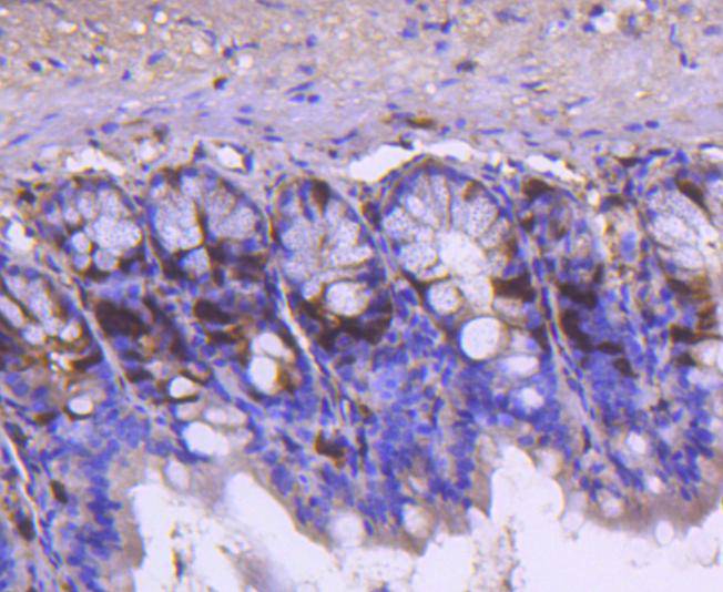 Immunohistochemical analysis of paraffin-embedded mouse colon tissue using anti-Cyclin A2 antibody. The section was pre-treated using heat mediated antigen retrieval with Tris-EDTA buffer (pH 8.0-8.4) for 20 minutes.The tissues were blocked in 5% BSA for 30 minutes at room temperature, washed with ddH2O and PBS, and then probed with the primary antibody (ET1612-26, 1/50) for 30 minutes at room temperature. The detection was performed using an HRP conjugated compact polymer system. DAB was used as the chromogen. Tissues were counterstained with hematoxylin and mounted with DPX.