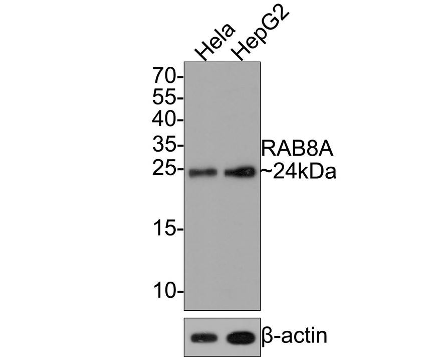 Western blot analysis of RAB8A on different lysates with Rabbit anti-RAB8A antibody (HA721127) at 1/500 dilution.<br />
<br />
Lane 1: Hela cell lysate<br />
Lane 2: HepG2 cell lysate<br />
<br />
Lysates/proteins at 10 µg/Lane.<br />
<br />
Predicted band size: 24 kDa<br />
Observed band size: 24 kDa<br />
<br />
Exposure time: 2 minutes;<br />
<br />
15% SDS-PAGE gel.<br />
<br />
Proteins were transferred to a PVDF membrane and blocked with 5% NFDM/TBST for 1 hour at room temperature. The primary antibody (HA721127) at 1/500 dilution was used in 5% NFDM/TBST at room temperature for 2 hours. Goat Anti-Rabbit IgG - HRP Secondary Antibody (HA1001) at 1:300,000 dilution was used for 1 hour at room temperature.