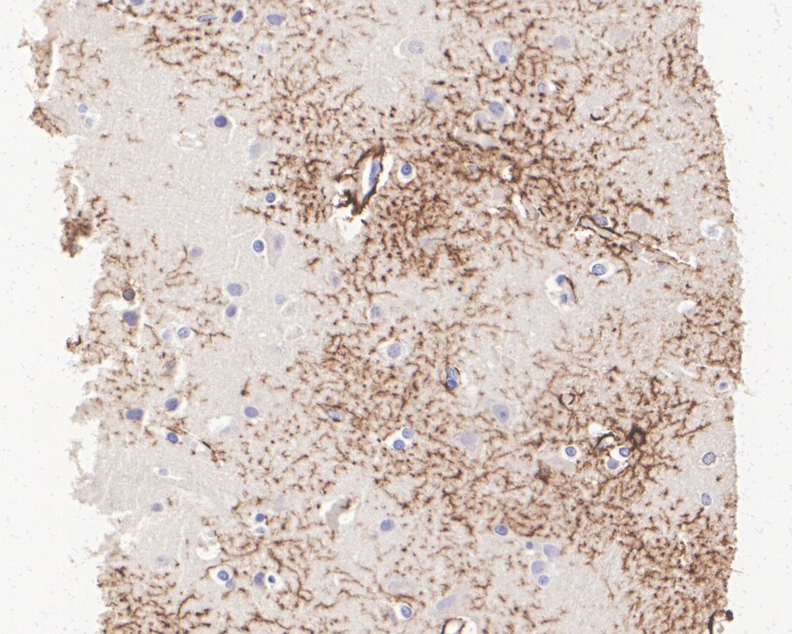 Immunohistochemical analysis of paraffin-embedded rat hippocampus tissue with Mouse anti-GFAP antibody (EM140707) at 1/600 dilution.<br />
<br />
The section was pre-treated using heat mediated antigen retrieval with Tris-EDTA buffer (pH 9.0) for 20 minutes. The tissues were blocked in 1% BSA for 20 minutes at room temperature, washed with ddH2O and PBS, and then probed with the primary antibody (EM140707) at 1/600 dilution for 1 hour at room temperature. The detection was performed using an HRP conjugated compact polymer system. DAB was used as the chromogen. Tissues were counterstained with hematoxylin and mounted with DPX.