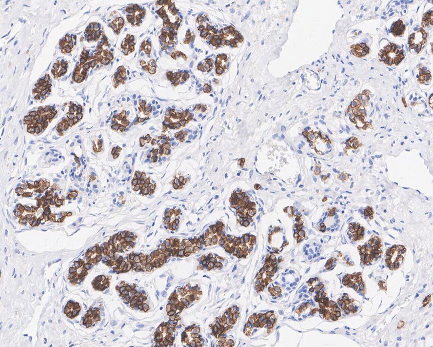 Immunohistochemical analysis of paraffin-embedded human spleen tissue using anti-c-Kit antibody. The section was pre-treated using heat mediated antigen retrieval with Tris-EDTA buffer (pH 9.0) for 20 minutes.The tissues were blocked in 5% BSA for 30 minutes at room temperature, washed with ddH2O and PBS, and then probed with the primary antibody (ET1609-60, 1/50) for 30 minutes at room temperature. The detection was performed using an HRP conjugated compact polymer system. DAB was used as the chromogen. Tissues were counterstained with hematoxylin and mounted with DPX.