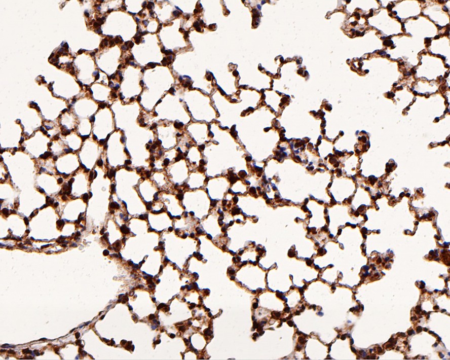 Immunohistochemical analysis of paraffin-embedded mouse lung tissue with Rabbit anti-Ubiquitin antibody (ER31212) at 1/1,000 dilution.<br />
<br />
The section was pre-treated using heat mediated antigen retrieval with sodium citrate buffer (pH 6.0) for 2 minutes. The tissues were blocked in 1% BSA for 20 minutes at room temperature, washed with ddH2O and PBS, and then probed with the primary antibody (ER31212) at 1/1,000 dilution for 1 hour at room temperature. The detection was performed using an HRP conjugated compact polymer system. DAB was used as the chromogen. Tissues were counterstained with hematoxylin and mounted with DPX.