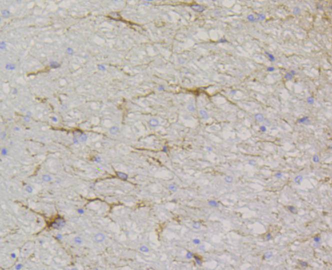 Immunohistochemical analysis of paraffin-embedded rat cerebellum tissue with Rabbit anti-GFAP antibody (ET1601-23) at 1/200 dilution.<br />
<br />
The section was pre-treated using heat mediated antigen retrieval with Tris-EDTA buffer (pH 9.0) for 20 minutes. The tissues were blocked in 1% BSA for 20 minutes at room temperature, washed with ddH2O and PBS, and then probed with the primary antibody (ET1601-23) at 1/200 dilution for 1 hour at room temperature. The detection was performed using an HRP conjugated compact polymer system. DAB was used as the chromogen. Tissues were counterstained with hematoxylin and mounted with DPX.