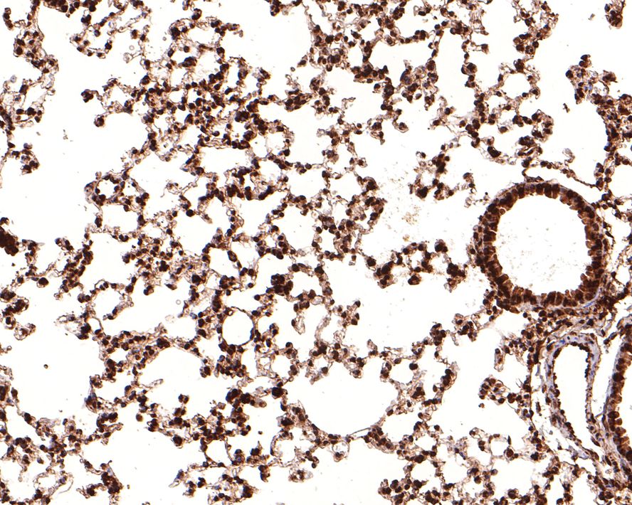 Immunohistochemical analysis of paraffin-embedded mouse lung tissue with Rabbit anti-CBFb antibody (ET7108-87) at 1/400 dilution.<br />
<br />
The section was pre-treated using heat mediated antigen retrieval with sodium citrate buffer (pH 6.0) for 2 minutes. The tissues were blocked in 1% BSA for 20 minutes at room temperature, washed with ddH2O and PBS, and then probed with the primary antibody (ET7108-87) at 1/400 dilution for 1 hour at room temperature. The detection was performed using an HRP conjugated compact polymer system. DAB was used as the chromogen. Tissues were counterstained with hematoxylin and mounted with DPX.