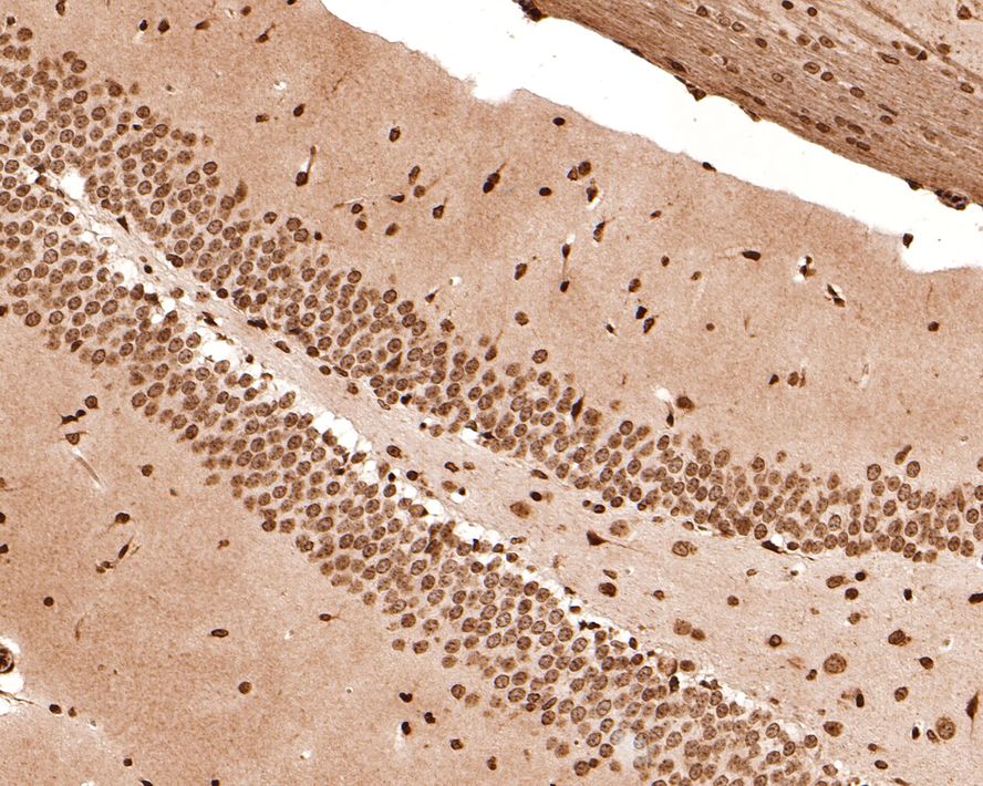 Immunohistochemical analysis of paraffin-embedded mouse hippocampus tissue with Rabbit anti-CBFb antibody (ET7108-87) at 1/400 dilution.<br />
<br />
The section was pre-treated using heat mediated antigen retrieval with sodium citrate buffer (pH 6.0) for 2 minutes. The tissues were blocked in 1% BSA for 20 minutes at room temperature, washed with ddH2O and PBS, and then probed with the primary antibody (ET7108-87) at 1/400 dilution for 1 hour at room temperature. The detection was performed using an HRP conjugated compact polymer system. DAB was used as the chromogen. Tissues were counterstained with hematoxylin and mounted with DPX.