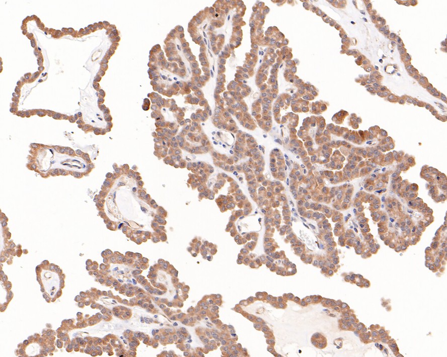 Immunohistochemical analysis of paraffin-embedded mouse brain tissue with Rabbit anti-Phospho-GSK3 (alpha+beta) (Y216+Y279) antibody (ET1607-54) at 1/200 dilution.<br />
<br />
The section was pre-treated using heat mediated antigen retrieval with sodium citrate buffer (pH 6.0) for 2 minutes. The tissues were blocked in 1% BSA for 20 minutes at room temperature, washed with ddH2O and PBS, and then probed with the primary antibody (ET1607-54) at 1/200 dilution for 1 hour at room temperature. The detection was performed using an HRP conjugated compact polymer system. DAB was used as the chromogen. Tissues were counterstained with hematoxylin and mounted with DPX.