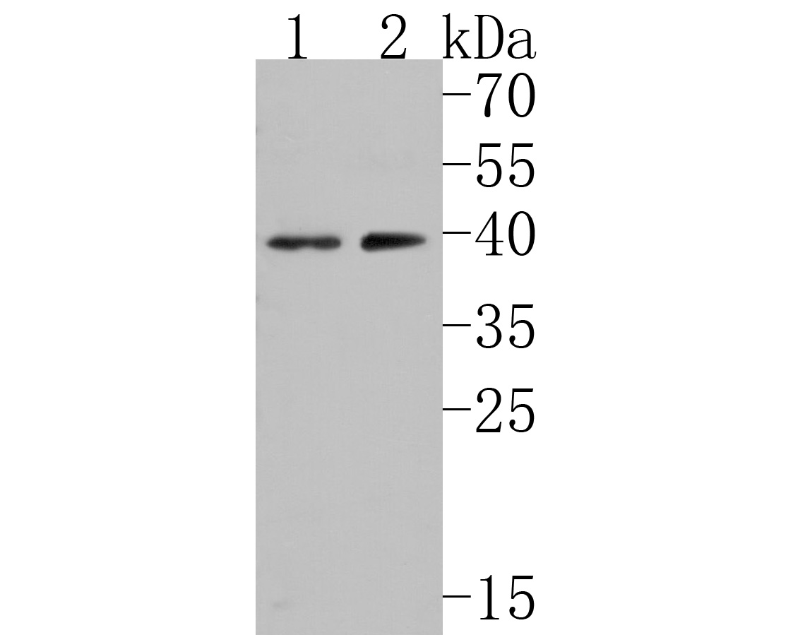 Western blot analysis of PAR1 on different lysates. Proteins were transferred to a PVDF membrane and blocked with 5% BSA in PBS for 1 hour at room temperature. The primary antibody (HA500159, 1/1,000) was used in 5% BSA at room temperature for 2 hours. Goat Anti-Rabbit IgG - HRP Secondary Antibody (HA1001) at 1:200,000 dilution was used for 1 hour at room temperature.<br />
Positive control: <br />
Lane 1: Jurkat cell lysate<br />
Lane 2: Human kidney tissue lysate