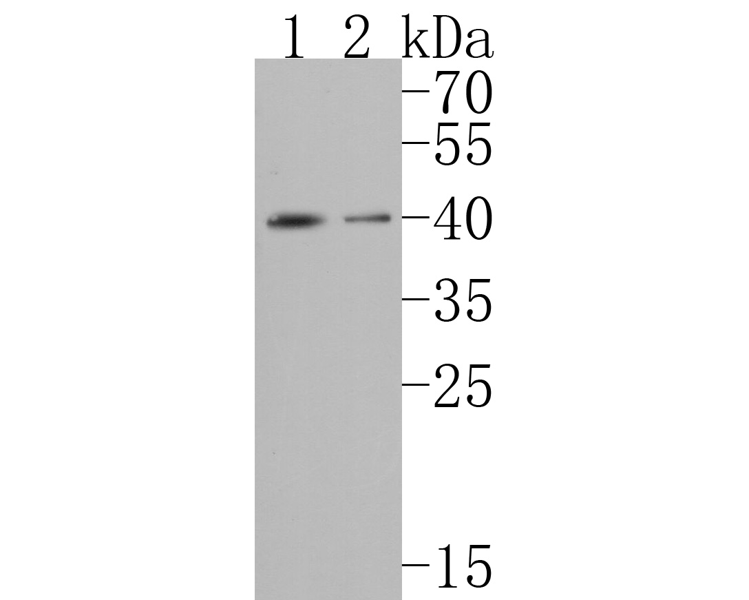 Western blot analysis of PAR1 on different lysates. Proteins were transferred to a PVDF membrane and blocked with 5% BSA in PBS for 1 hour at room temperature. The primary antibody (HA500159, 1/1,000) was used in 5% BSA at room temperature for 2 hours. Goat Anti-Rabbit IgG - HRP Secondary Antibody (HA1001) at 1:200,000 dilution was used for 1 hour at room temperature.<br />
Positive control: <br />
Lane 1: Rat kidney tissue lysate<br />
Lane 2: Mouse kidney tissue lysate
