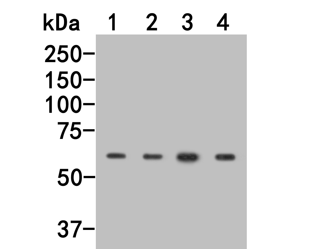 Western blot analysis of PPP2R1A on different lysates. Proteins were transferred to a PVDF membrane and blocked with 5% BSA in PBS for 1 hour at room temperature. The primary antibody (HA500160, 1/1,000) was used in 5% BSA at room temperature for 2 hours. Goat Anti-Rabbit IgG - HRP Secondary Antibody (HA1001) at 1:200,000 dilution was used for 1 hour at room temperature.<br />
Positive control: <br />
Lane 1: Hela cell lysate<br />
Lane 2: 293 cell lysate<br />
Lane 3: Mouse cerebellum tissue lysate<br />
Lane 4: Rat brain tissue lysate