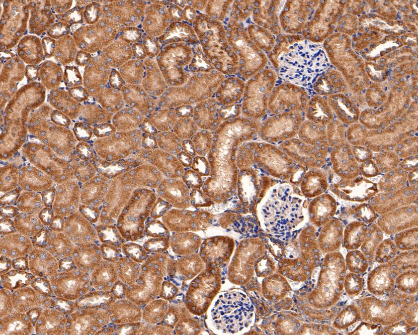 Immunohistochemical analysis of paraffin-embedded mouse kidney tissue using anti-IL-22RA1 antibody. The section was pre-treated using heat mediated antigen retrieval with Tris-EDTA buffer (pH 9.0) for 20 minutes.The tissues were blocked in 1% BSA for 30 minutes at room temperature, washed with ddH2O and PBS, and then probed with the primary antibody (HA500327, 1/200) for 30 minutes at room temperature. The detection was performed using an HRP conjugated compact polymer system. DAB was used as the chromogen. Tissues were counterstained with hematoxylin and mounted with DPX.