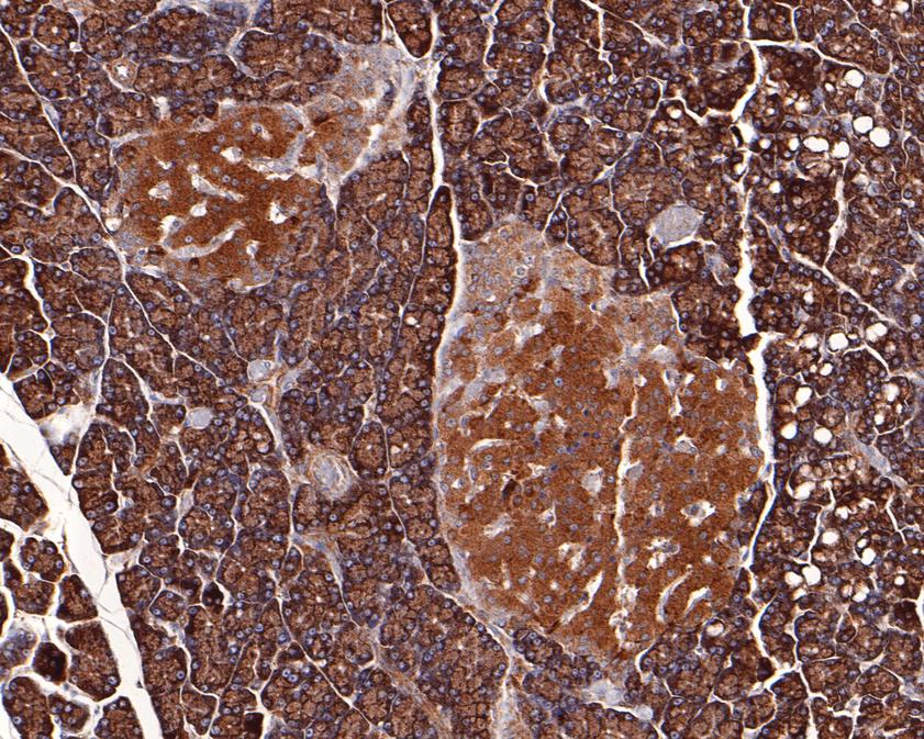 Immunohistochemical analysis of paraffin-embedded rat pancreas tissue using anti-IL-22RA1 antibody. The section was pre-treated using heat mediated antigen retrieval with Tris-EDTA buffer (pH 9.0) for 20 minutes.The tissues were blocked in 1% BSA for 30 minutes at room temperature, washed with ddH2O and PBS, and then probed with the primary antibody (HA500327, 1/200) for 30 minutes at room temperature. The detection was performed using an HRP conjugated compact polymer system. DAB was used as the chromogen. Tissues were counterstained with hematoxylin and mounted with DPX.