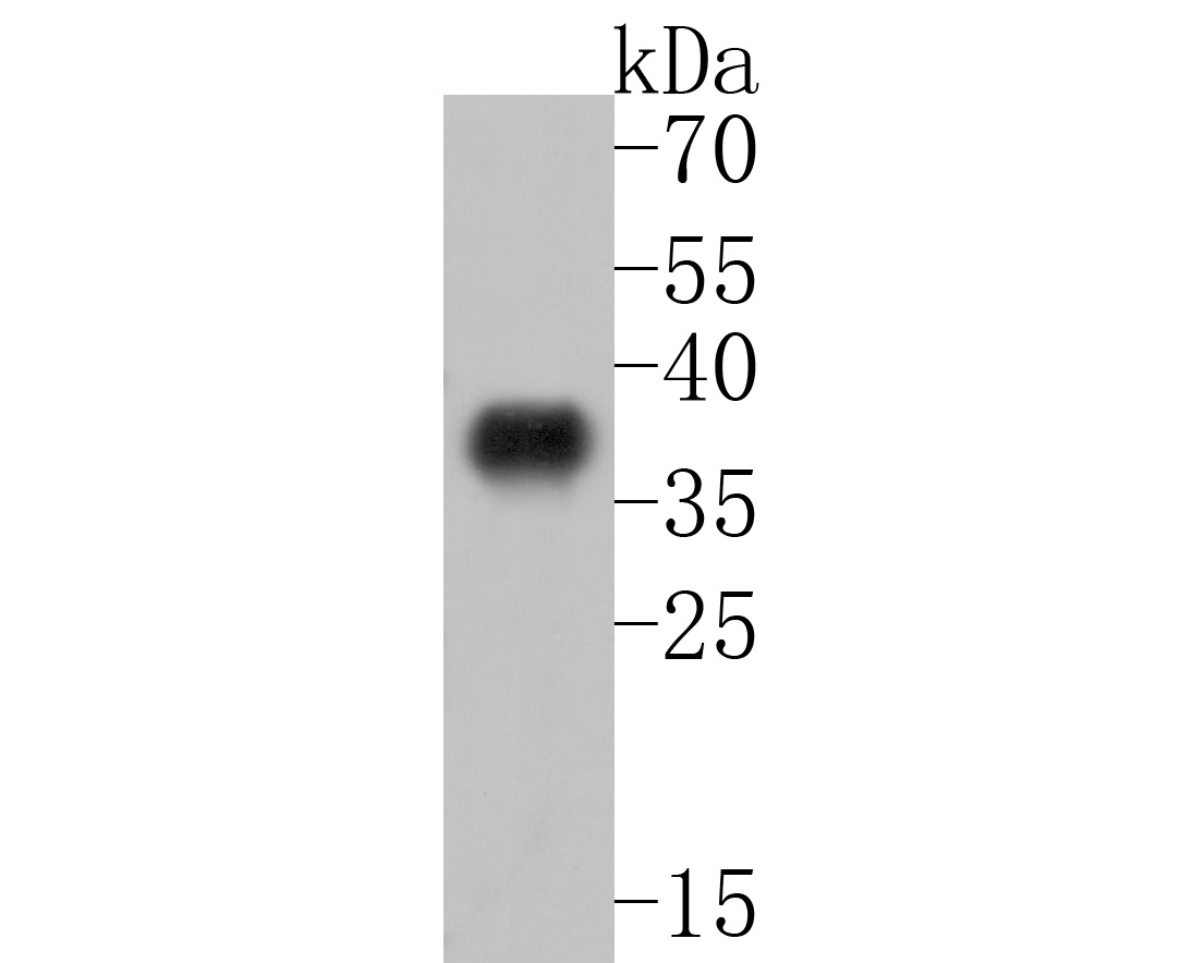 Western blot analysis of Abhydrolase_3 domain-containing protein on recombinant protein lysates. Proteins were transferred to a PVDF membrane and blocked with 5% BSA in PBS for 1 hour at room temperature. The primary antibody (HA600039, 1/500) was used in 5% BSA at room temperature for 2 hours. Goat Anti-Mouse IgG - HRP Secondary Antibody (HA1006) at 1:20,000 dilution was used for 1 hour at room temperature.