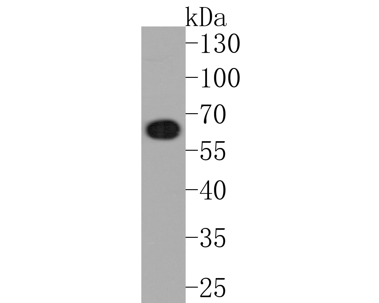Western blot analysis of COASY on HepG2 cell lysates with Rabbit anti-COASY antibody (HA721128) at 1/500 dilution.<br />
<br />
Lysates/proteins at 10 µg/Lane.<br />
<br />
Predicted band size: 60 kDa<br />
Observed band size: 60 kDa<br />
<br />
Exposure time: 2 minutes;<br />
<br />
10% SDS-PAGE gel.<br />
<br />
Proteins were transferred to a PVDF membrane and blocked with 5% NFDM/TBST for 1 hour at room temperature. The primary antibody (HA721128) at 1/500 dilution was used in 5% NFDM/TBST at room temperature for 2 hours. Goat Anti-Rabbit IgG - HRP Secondary Antibody (HA1001) at 1:200,000 dilution was used for 1 hour at room temperature.