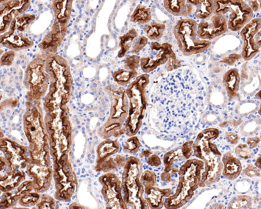 Immunohistochemical analysis of paraffin-embedded human kidney tissue with Rabbit anti-Villin1 antibody (HA721129) at 1/3,500 dilution.<br />
<br />
The section was pre-treated using heat mediated antigen retrieval with Tris-EDTA buffer (pH 9.0) for 20 minutes. The tissues were blocked in 1% BSA for 20 minutes at room temperature, washed with ddH2O and PBS, and then probed with the primary antibody (HA721129) at 1/3,500 dilution for 1 hour at room temperature. The detection was performed using an HRP conjugated compact polymer system. DAB was used as the chromogen. Tissues were counterstained with hematoxylin and mounted with DPX.