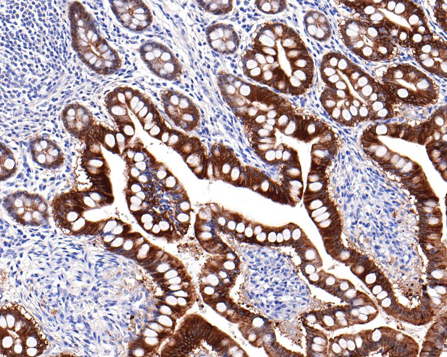 Immunohistochemical analysis of paraffin-embedded human small intestine tissue with Rabbit anti-Villin1 antibody (HA721129) at 1/3,500 dilution.<br />
<br />
The section was pre-treated using heat mediated antigen retrieval with Tris-EDTA buffer (pH 9.0) for 20 minutes. The tissues were blocked in 1% BSA for 20 minutes at room temperature, washed with ddH2O and PBS, and then probed with the primary antibody (HA721129) at 1/3,500 dilution for 1 hour at room temperature. The detection was performed using an HRP conjugated compact polymer system. DAB was used as the chromogen. Tissues were counterstained with hematoxylin and mounted with DPX.