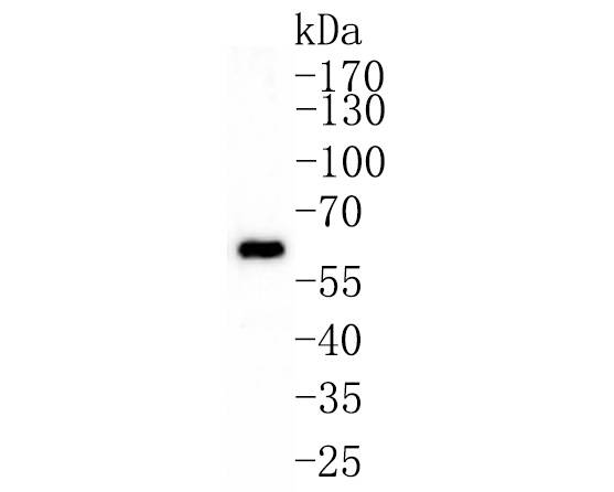 Western blot analysis of GRB7 on SK-Br-3 cell lysates. Proteins were transferred to a PVDF membrane and blocked with 5% BSA in PBS for 1 hour at room temperature. The primary antibody (HA500328, 1/5,000) was used in 5% BSA at room temperature for 2 hours. Goat Anti-Rabbit IgG - HRP Secondary Antibody (HA1001) at 1:200,000 dilution was used for 1 hour at room temperature.<br />
<br />
Western blot analysis of GRB7 on SK-Br-3 cell lysates with Rabbit anti-GRB7 antibody (HA500328) at 1/2,000 dilution.<br />
<br />
Lysates/proteins at 20 µg/Lane.<br />
<br />
Predicted band size: 60 kDa<br />
Observed band size: 60 kDa<br />
<br />
Exposure time: 2 minutes;<br />
<br />
10% SDS-PAGE gel.<br />
<br />
Proteins were transferred to a PVDF membrane and blocked with 5% NFDM/TBST for 1 hour at room temperature. The primary antibody (HA500328) at 1/2,000 dilution was used in 5% NFDM/TBST at room temperature for 2 hours. Goat Anti-Rabbit IgG - HRP Secondary Antibody (HA1001) at 1:200,000 dilution was used for 1 hour at room temperature.
