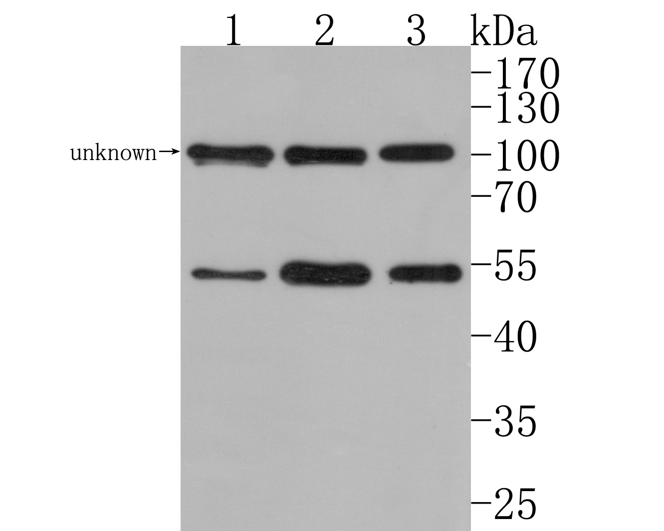 Western blot analysis of Bcl2-L-13 on different lysates with Rabbit anti-Bcl2-L-13 antibody (HA500329) at 1/500 dilution.<br />
<br />
Lane 1: Hela cell lysate<br />
Lane 2: Jurkat cell lysate<br />
Lane 3: Raji cell lysate<br />
<br />
Lysates/proteins at 10 µg/Lane.<br />
<br />
Predicted band size: 53 kDa<br />
Observed band size: 53 kDa<br />
<br />
Exposure time: 2 minutes;<br />
<br />
10% SDS-PAGE gel.<br />
<br />
Proteins were transferred to a PVDF membrane and blocked with 5% NFDM/TBST for 1 hour at room temperature. The primary antibody (HA500329) at 1/500 dilution was used in 5% NFDM/TBST at room temperature for 2 hours. Goat Anti-Rabbit IgG - HRP Secondary Antibody (HA1001) at 1:200,000 dilution was used for 1 hour at room temperature.