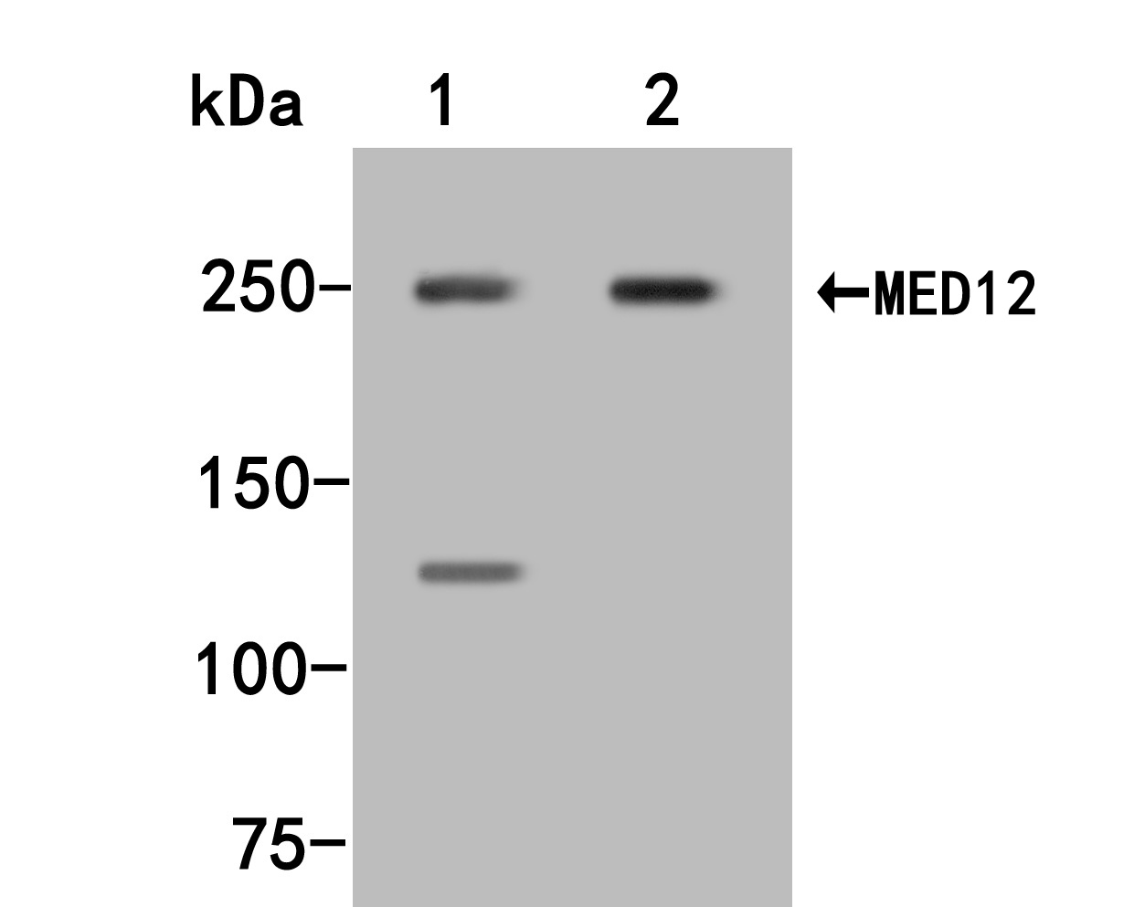 Western blot analysis of MED12 on different lysates with Rabbit anti-MED12 antibody (HA500331) at 1/500 dilution.<br />
<br />
Lane 1: Hela cell lysate<br />
Lane 2: K562 cell lysate<br />
<br />
Lysates/proteins at 10 µg/Lane.<br />
<br />
Predicted band size: 53 kDa<br />
Observed band size: 53 kDa<br />
<br />
Exposure time: 2 minutes;<br />
<br />
10% SDS-PAGE gel.<br />
<br />
Proteins were transferred to a PVDF membrane and blocked with 5% NFDM/TBST for 1 hour at room temperature. The primary antibody (HA500331) at 1/500 dilution was used in 5% NFDM/TBST at room temperature for 2 hours. Goat Anti-Rabbit IgG - HRP Secondary Antibody (HA1001) at 1:200,000 dilution was used for 1 hour at room temperature.