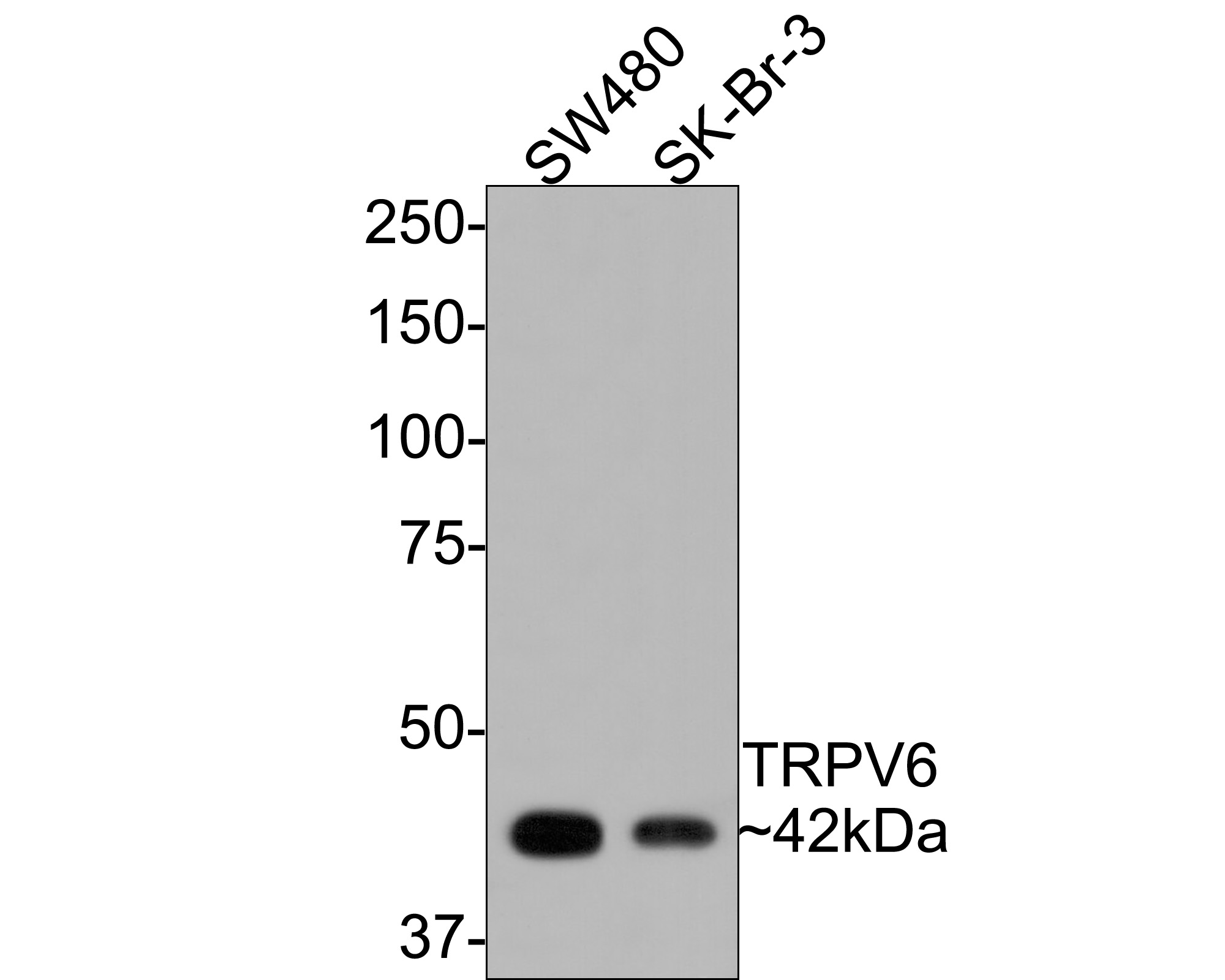 Western blot analysis of TRPV6 on different lysates with Rabbit anti-TRPV6 antibody (HA500333) at 1/500 dilution.<br />
<br />
Lane 1: SW480 cell lysate<br />
Lane 2: SK-Br-3 cell lysate<br />
<br />
Lysates/proteins at 10 µg/Lane.<br />
<br />
Predicted band size: 87 kDa<br />
Observed band size: 42 kDa (unglycosylated monomeric form of TRPV6)<br />
<br />
Exposure time: 30 seconds;<br />
<br />
8% SDS-PAGE gel.<br />
<br />
Proteins were transferred to a PVDF membrane and blocked with 5% NFDM/TBST for 1 hour at room temperature. The primary antibody (HA500333) at 1/500 dilution was used in 5% NFDM/TBST at room temperature for 2 hours. Goat Anti-Rabbit IgG - HRP Secondary Antibody (HA1001) at 1:300,000 dilution was used for 1 hour at room temperature.