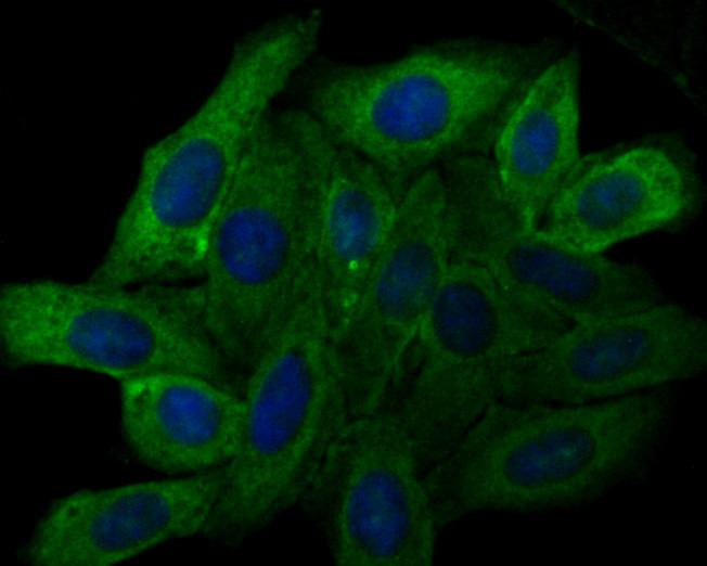 ICC staining of TRPV6 in HepG2 cells (green). Formalin fixed cells were permeabilized with 0.1% Triton X-100 in TBS for 10 minutes at room temperature and blocked with 1% Blocker BSA for 15 minutes at room temperature. Cells were probed with the primary antibody (HA500333, 1/100) for 1 hour at room temperature, washed with PBS. Alexa Fluor®488 Goat anti-Rabbit IgG was used as the secondary antibody at 1/100 dilution. The nuclear counter stain is DAPI (blue).