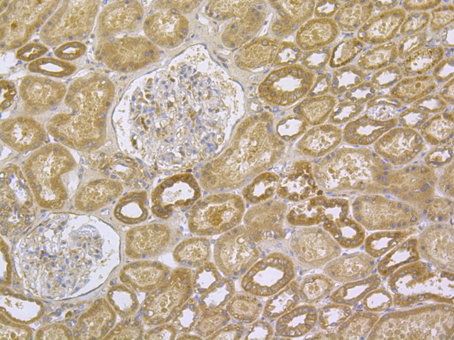 Immunohistochemical analysis of paraffin-embedded human kidney tissue using anti-TRPV6 antibody. The section was pre-treated using heat mediated antigen retrieval with Tris-EDTA buffer (pH 8.0-8.4) for 20 minutes.The tissues were blocked in 5% BSA for 30 minutes at room temperature, washed with ddH2O and PBS, and then probed with the primary antibody (HA500333, 1/50) for 30 minutes at room temperature. The detection was performed using an HRP conjugated compact polymer system. DAB was used as the chromogen. Tissues were counterstained with hematoxylin and mounted with DPX.