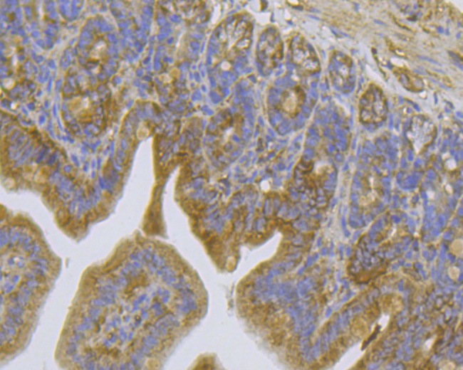 Immunohistochemical analysis of paraffin-embedded mouse colon tissue using anti-TRPV6 antibody. The section was pre-treated using heat mediated antigen retrieval with Tris-EDTA buffer (pH 8.0-8.4) for 20 minutes.The tissues were blocked in 5% BSA for 30 minutes at room temperature, washed with ddH2O and PBS, and then probed with the primary antibody (HA500333, 1/50) for 30 minutes at room temperature. The detection was performed using an HRP conjugated compact polymer system. DAB was used as the chromogen. Tissues were counterstained with hematoxylin and mounted with DPX.