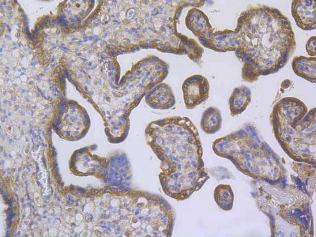 Immunohistochemical analysis of paraffin-embedded human placenta tissue using anti-TRPV6 antibody. The section was pre-treated using heat mediated antigen retrieval with Tris-EDTA buffer (pH 8.0-8.4) for 20 minutes.The tissues were blocked in 5% BSA for 30 minutes at room temperature, washed with ddH2O and PBS, and then probed with the primary antibody (HA500333, 1/200) for 30 minutes at room temperature. The detection was performed using an HRP conjugated compact polymer system. DAB was used as the chromogen. Tissues were counterstained with hematoxylin and mounted with DPX.