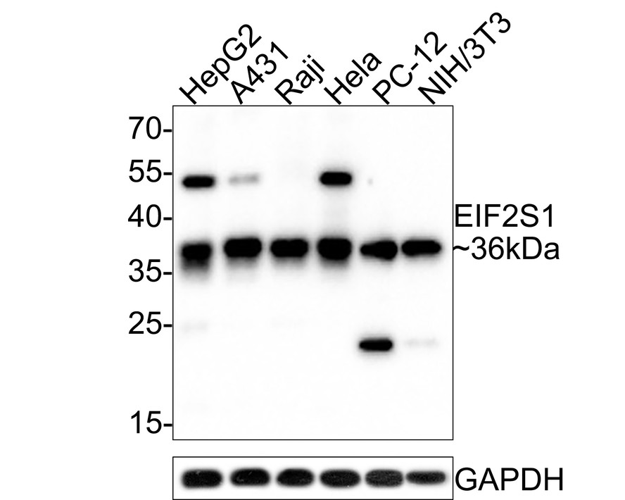 Western blot analysis of EIF2S1 on different lysates with Rabbit anti-EIF2S1 antibody (HA500385) at 1/1,000 dilution.<br />
<br />
Lane 1: HepG2 cell lysate<br />
Lane 2: A431 cell lysate<br />
Lane 3: Raji cell lysate<br />
Lane 4: Hela cell lysate<br />
Lane 5: PC-12 cell lysate<br />
Lane 6: NIH/3T3 cell lysate<br />
<br />
Lysates/proteins at 10 µg/Lane.<br />
<br />
Predicted band size: 36 kDa<br />
Observed band size: 36 kDa<br />
<br />
Exposure time: 21 seconds;<br />
<br />
12% SDS-PAGE gel.<br />
<br />
Proteins were transferred to a PVDF membrane and blocked with 5% NFDM/TBST for 1 hour at room temperature. The primary antibody (HA500385) at 1/1,000 dilution was used in 5% NFDM/TBST at room temperature for 2 hours. Goat Anti-Rabbit IgG - HRP Secondary Antibody (HA1001) at 1:300,000 dilution was used for 1 hour at room temperature.
