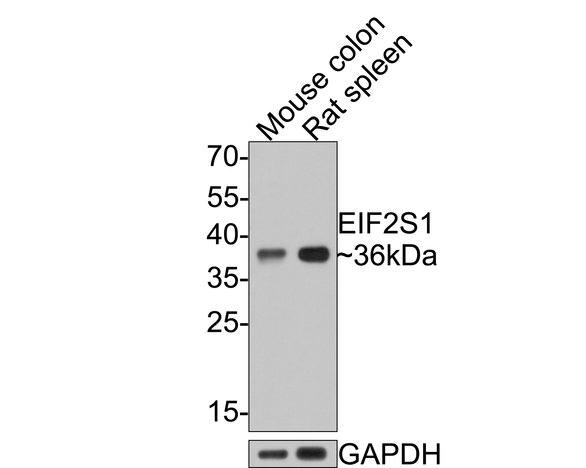 Western blot analysis of EIF2S1 on different lysates with Rabbit anti-EIF2S1 antibody (HA500385) at 1/500 dilution.<br />
<br />
Lane 1: Mouse colon tissue lysate<br />
Lane 2: Rat spleen tissue lysate<br />
<br />
Lysates/proteins at 20 µg/Lane.<br />
<br />
Predicted band size: 36 kDa<br />
Observed band size: 36 kDa<br />
<br />
Exposure time: 30 seconds;<br />
<br />
12% SDS-PAGE gel.<br />
<br />
Proteins were transferred to a PVDF membrane and blocked with 5% NFDM/TBST for 1 hour at room temperature. The primary antibody (HA500385) at 1/500 dilution was used in 5% NFDM/TBST at room temperature for 2 hours. Goat Anti-Rabbit IgG - HRP Secondary Antibody (HA1001) at 1:300,000 dilution was used for 1 hour at room temperature.