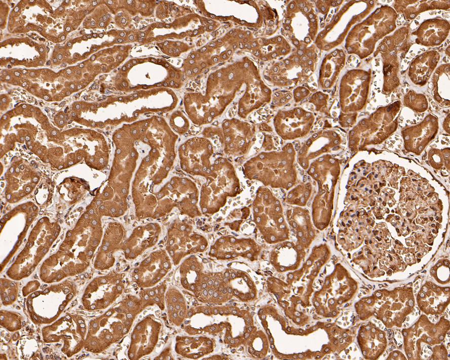 Immunohistochemical analysis of paraffin-embedded human kidney tissue with Mouse anti-EIF2S1 antibody (HA500385) at 1/1,900 dilution.<br />
<br />
The section was pre-treated using heat mediated antigen retrieval with Tris-EDTA buffer (pH 9.0) for 20 minutes. The tissues were blocked in 1% BSA for 20 minutes at room temperature, washed with ddH2O and PBS, and then probed with the primary antibody (HA500385) at 1/1,900 dilution for 1 hour at room temperature. The detection was performed using an HRP conjugated compact polymer system. DAB was used as the chromogen. Tissues were counterstained with hematoxylin and mounted with DPX.