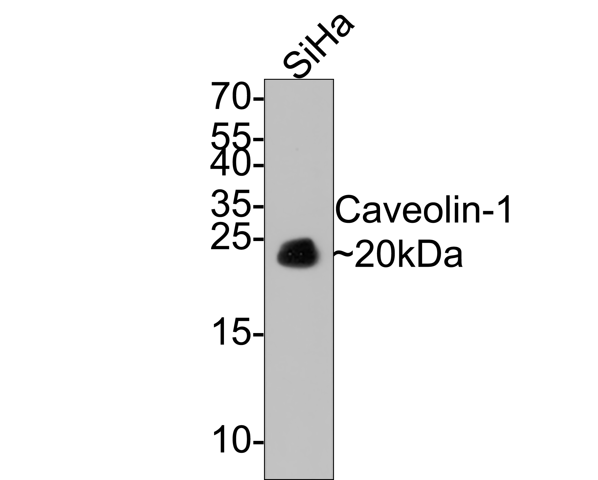 Western blot analysis of Caveolin-1 on SiHa cell lysates with Mouse anti-Caveolin-1 antibody (HA601005) at 1/500 dilution.<br />
<br />
Lysates/proteins at 10 µg/Lane.<br />
<br />
Predicted band size: 20 kDa<br />
Observed band size: 20 kDa<br />
<br />
Exposure time: 1 minute;<br />
<br />
15% SDS-PAGE gel.<br />
<br />
Proteins were transferred to a PVDF membrane and blocked with 5% NFDM/TBST for 1 hour at room temperature. The primary antibody (HA601005) at 1/500 dilution was used in 5% NFDM/TBST at room temperature for 2 hours. Goat Anti-Mouse IgG - HRP Secondary Antibody (HA1006) at 1:100,000 dilution was used for 1 hour at room temperature.