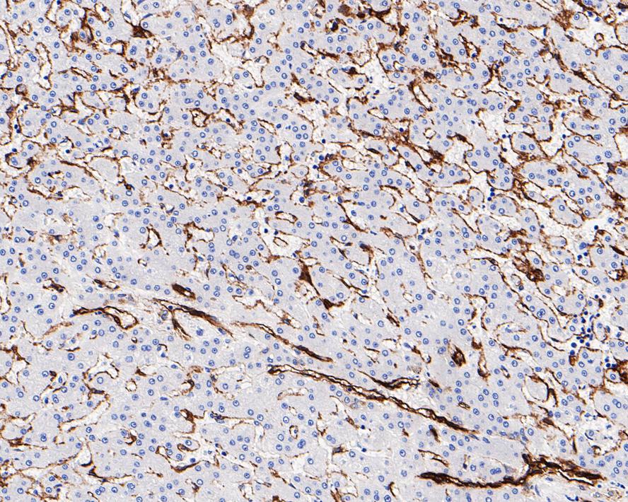 Immunohistochemical analysis of paraffin-embedded human liver tissue with Mouse anti-Caveolin-1 antibody (HA601005) at 1/800 dilution.<br />
<br />
The section was pre-treated using heat mediated antigen retrieval with Tris-EDTA buffer (pH 9.0) for 20 minutes. The tissues were blocked in 1% BSA for 20 minutes at room temperature, washed with ddH2O and PBS, and then probed with the primary antibody (HA601005) at 1/800 dilution for 1 hour at room temperature. The detection was performed using an HRP conjugated compact polymer system. DAB was used as the chromogen. Tissues were counterstained with hematoxylin and mounted with DPX.