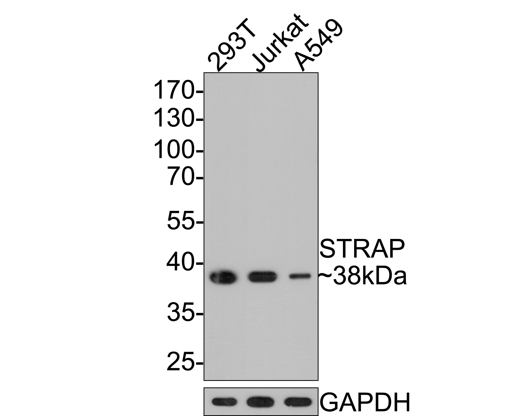 Western blot analysis of STRAP on different lysates with Mouse anti-STRAP antibody (HA601007) at 1/500 dilution.<br />
<br />
Lane 1: 293T cell lysate<br />
Lane 2: Jurkat cell lysate<br />
Lane 3: A549 cell lysate<br />
<br />
Lysates/proteins at 10 µg/Lane.<br />
<br />
Predicted band size: 38 kDa<br />
Observed band size: 38 kDa<br />
<br />
Exposure time: 2 minutes;<br />
<br />
10% SDS-PAGE gel.<br />
<br />
Proteins were transferred to a PVDF membrane and blocked with 5% NFDM/TBST for 1 hour at room temperature. The primary antibody (HA601007) at 1/500 dilution was used in 5% NFDM/TBST at room temperature for 2 hours. Goat Anti-Mouse IgG - HRP Secondary Antibody (HA1006) at 1:100,000 dilution was used for 1 hour at room temperature.