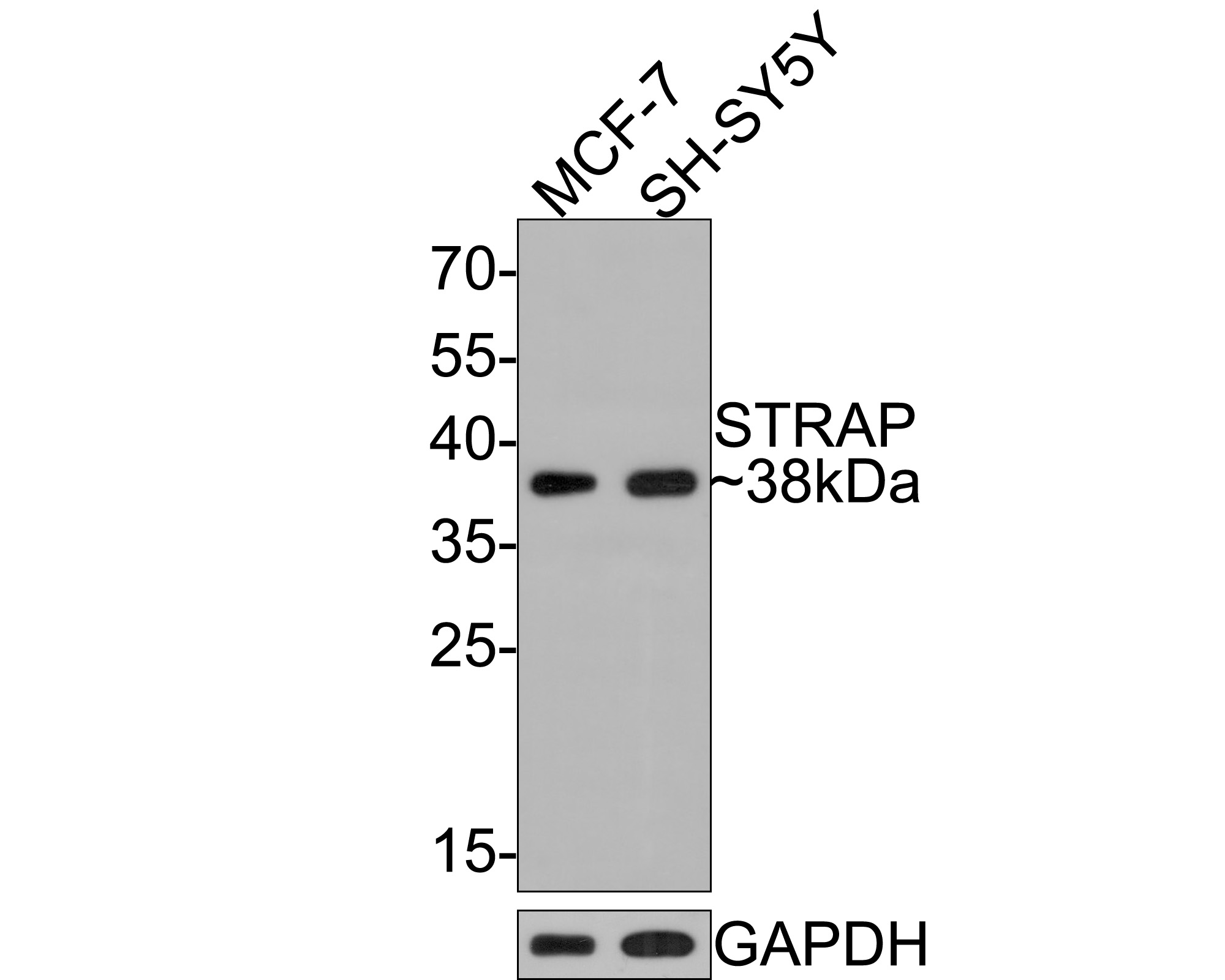 Western blot analysis of STRAP on different lysates with Mouse anti-STRAP antibody (HA601007) at 1/500 dilution.<br />
<br />
Lane 1: MCF-7 cell lysate<br />
Lane 2: SH-SY5Y cell lysate<br />
<br />
Lysates/proteins at 10 µg/Lane.<br />
<br />
Predicted band size: 38 kDa<br />
Observed band size: 38 kDa<br />
<br />
Exposure time: 1 minute;<br />
<br />
12% SDS-PAGE gel.<br />
<br />
Proteins were transferred to a PVDF membrane and blocked with 5% NFDM/TBST for 1 hour at room temperature. The primary antibody (HA601007) at 1/500 dilution was used in 5% NFDM/TBST at room temperature for 2 hours. Goat Anti-Mouse IgG - HRP Secondary Antibody (HA1006) at 1:100,000 dilution was used for 1 hour at room temperature.