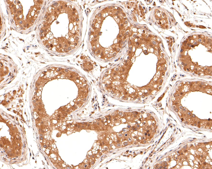 Immunohistochemical analysis of paraffin-embedded human testis tissue with Mouse anti-STRAP antibody (HA601007) at 1/200 dilution.<br />
<br />
The section was pre-treated using heat mediated antigen retrieval with sodium citrate buffer (pH 6.0) for 2 minutes. The tissues were blocked in 1% BSA for 20 minutes at room temperature, washed with ddH2O and PBS, and then probed with the primary antibody (HA601007) at 1/200 dilution for 1 hour at room temperature. The detection was performed using an HRP conjugated compact polymer system. DAB was used as the chromogen. Tissues were counterstained with hematoxylin and mounted with DPX.