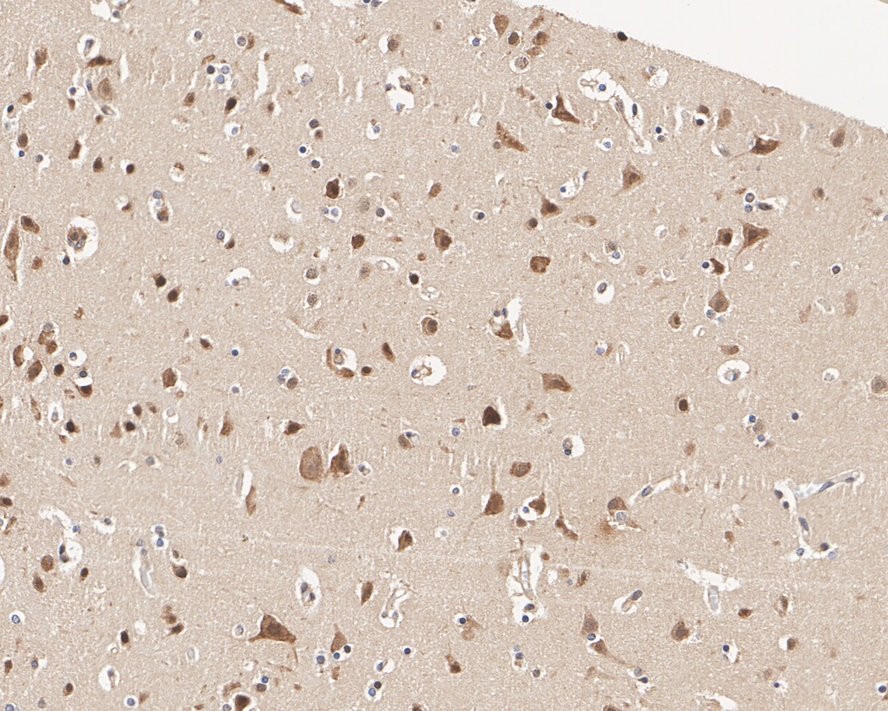 Immunohistochemical analysis of paraffin-embedded human esophagus tissue with Rabbit anti-BRCA1 antibody (HA601009) at 1/1,500 dilution.<br />
<br />
The section was pre-treated using heat mediated antigen retrieval with sodium citrate buffer (pH 6.0) for 2 minutes. The tissues were blocked in 1% BSA for 20 minutes at room temperature, washed with ddH2O and PBS, and then probed with the primary antibody (HA601009) at 1/1,500 dilution for 1 hour at room temperature. The detection was performed using an HRP conjugated compact polymer system. DAB was used as the chromogen. Tissues were counterstained with hematoxylin and mounted with DPX.