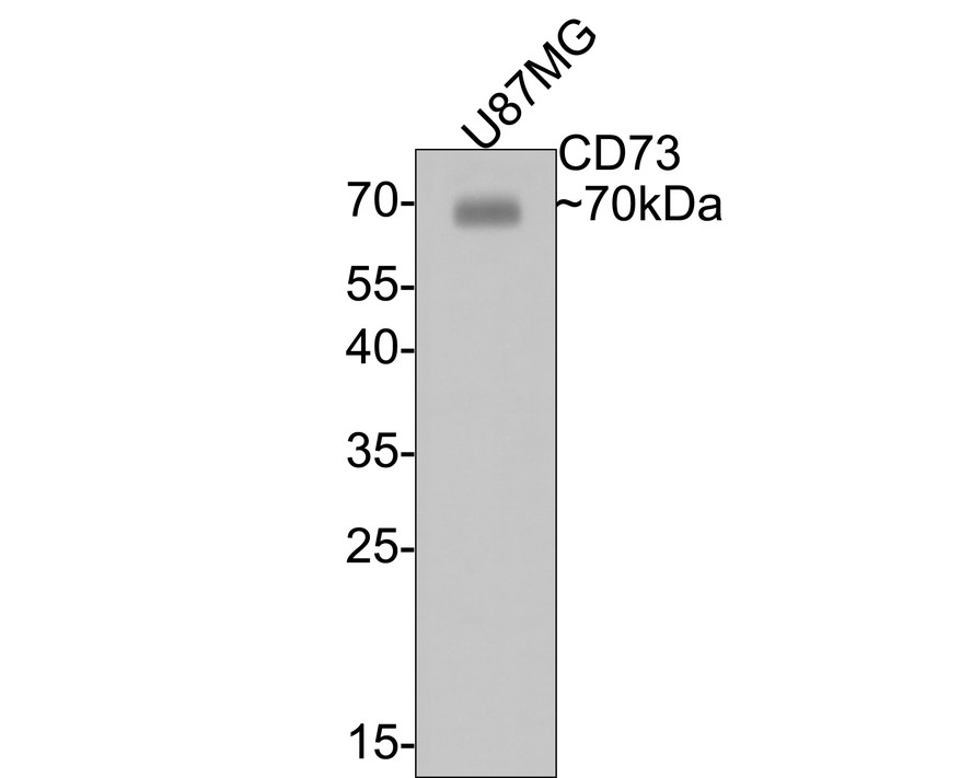 Western blot analysis of CD73 on U87MG cell lysates with Mouse anti-CD73 antibody (HA601010) at 1/500 dilution.<br />
<br />
Lysates/proteins at 10 µg/Lane.<br />
<br />
Predicted band size: 63 kDa<br />
Observed band size: 70 kDa<br />
<br />
Exposure time: 15 seconds;<br />
<br />
12% SDS-PAGE gel.<br />
<br />
Proteins were transferred to a PVDF membrane and blocked with 5% NFDM/TBST for 1 hour at room temperature. The primary antibody (HA601010) at 1/500 dilution was used in 5% NFDM/TBST at room temperature for 2 hours. Goat Anti-Mouse IgG - HRP Secondary Antibody (HA1006) at 1:100,000 dilution was used for 1 hour at room temperature.