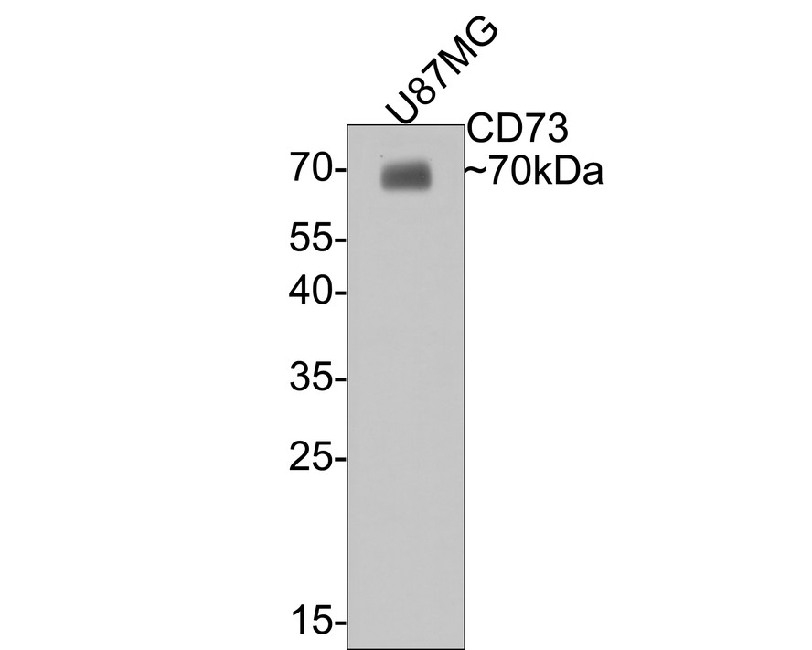 Western blot analysis of CD73 on U87MG cell lysates with Mouse anti-CD73 antibody (HA601012) at 1/500 dilution.<br />
<br />
Lysates/proteins at 10 µg/Lane.<br />
<br />
Predicted band size: 63 kDa<br />
Observed band size: 70 kDa<br />
<br />
Exposure time: 15 seconds;<br />
<br />
12% SDS-PAGE gel.<br />
<br />
Proteins were transferred to a PVDF membrane and blocked with 5% NFDM/TBST for 1 hour at room temperature. The primary antibody (HA601012) at 1/500 dilution was used in 5% NFDM/TBST at room temperature for 2 hours. Goat Anti-Mouse IgG - HRP Secondary Antibody (HA1006) at 1:100,000 dilution was used for 1 hour at room temperature.