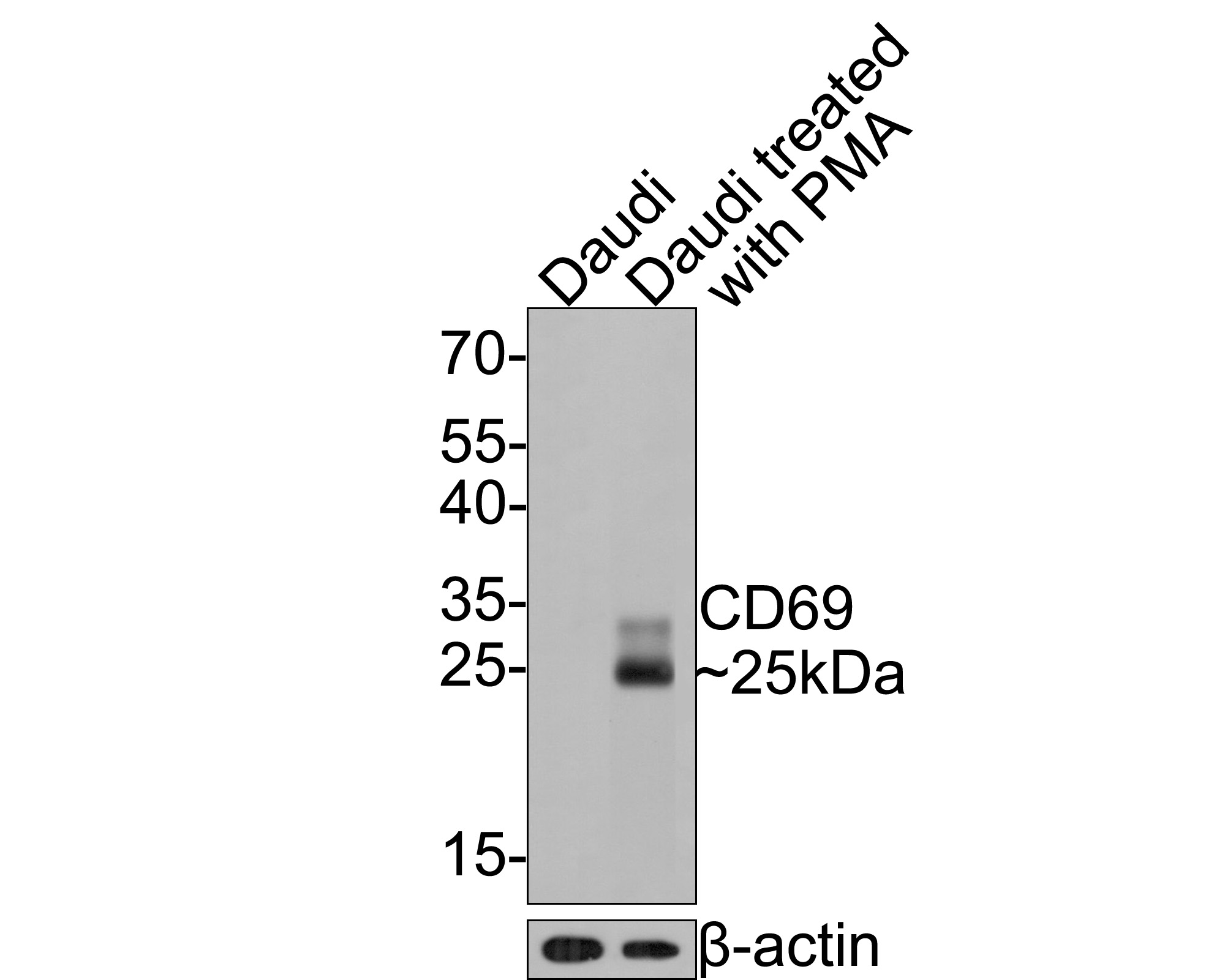 Western blot analysis of CD69 on different lysates with Mouse anti-CD69 antibody (HA601013) at 1/500 dilution.<br />
<br />
Lane 1: Daudi cell lysate<br />
Lane 2: Daudi cell lysate treated with PMA for 24 hours<br />
<br />
Lysates/proteins at 10 µg/Lane.<br />
<br />
Predicted band size: 23 kDa<br />
Observed band size: 25 kDa<br />
<br />
Exposure time: 30 seconds;<br />
<br />
12% SDS-PAGE gel.<br />
<br />
Proteins were transferred to a PVDF membrane and blocked with 5% NFDM/TBST for 1 hour at room temperature. The primary antibody (HA601013) at 1/500 dilution was used in 5% NFDM/TBST at room temperature for 2 hours. Goat Anti-Mouse IgG - HRP Secondary Antibody (HA1006) at 1:100,000 dilution was used for 1 hour at room temperature.