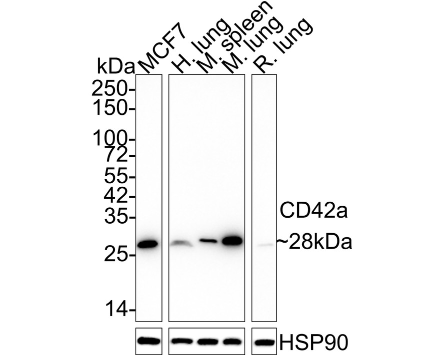 Western blot analysis of CD42a on different lysates with Mouse anti-CD42a antibody (HA601019) at 1/500 dilution.<br />
<br />
Lane 1: MCF-7 cell lysate, 10 µg/Lane.<br />
Lane 2: Mouse lung tissue lysate, 20 µg/Lane.<br />
<br />
Predicted band size: 19 kDa<br />
Observed band size: 30 kDa<br />
<br />
Exposure time: 2 minutes;<br />
<br />
15% SDS-PAGE gel.<br />
<br />
Proteins were transferred to a PVDF membrane and blocked with 5% NFDM/TBST for 1 hour at room temperature. The primary antibody (HA601019) at 1/500 dilution was used in 5% NFDM/TBST at room temperature for 2 hours. Goat Anti-Mouse IgG - HRP Secondary Antibody (HA1006) at 1:100,000 dilution was used for 1 hour at room temperature.