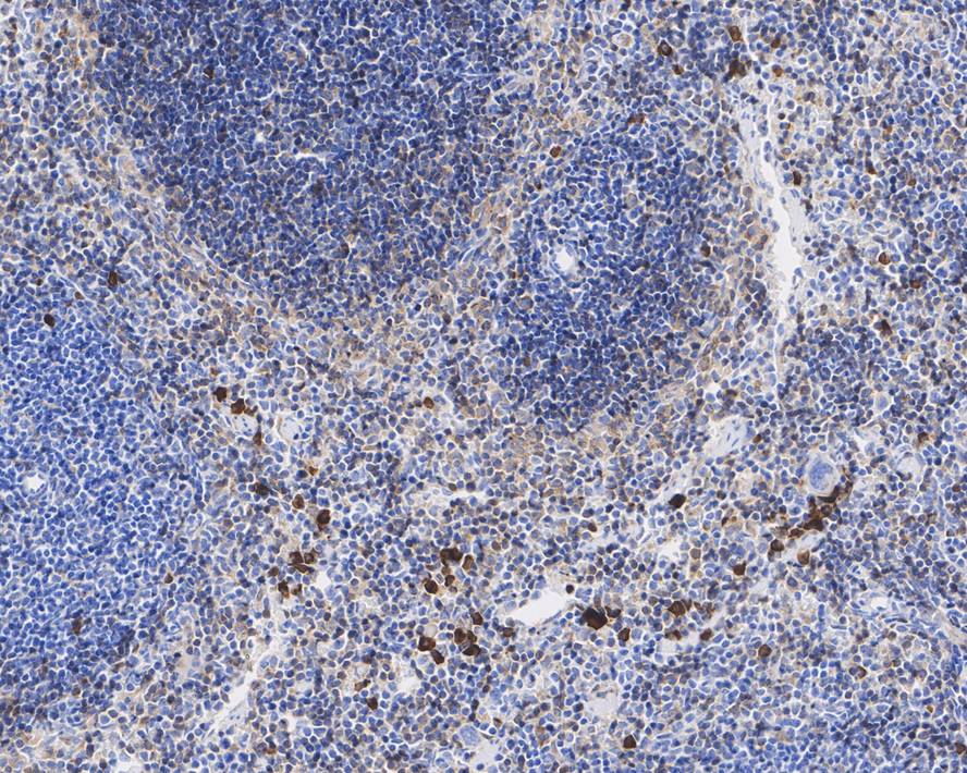 Immunohistochemical analysis of paraffin-embedded human spleen tissue using anti-CD42a antibody. The section was pre-treated using heat mediated antigen retrieval with Tris-EDTA buffer (pH 8.0-8.4) for 20 minutes.The tissues were blocked in 5% BSA for 30 minutes at room temperature, washed with ddH2O and PBS, and then probed with the primary antibody (HA601019, 1/400) for 30 minutes at room temperature. The detection was performed using an HRP conjugated compact polymer system. DAB was used as the chromogen. Tissues were counterstained with hematoxylin and mounted with DPX.