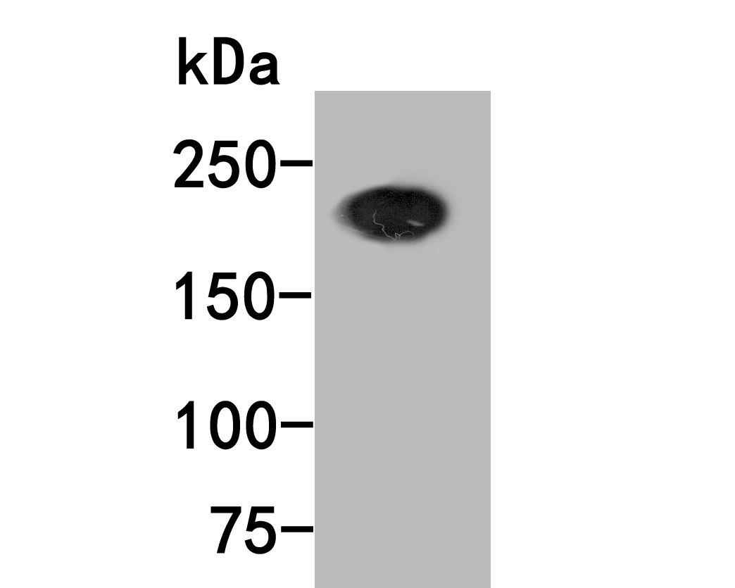 Western blot analysis of BRG1 on different lysates with Mouse anti-BRG1 antibody (HA601020) at 1/500 dilution.<br />
<br />
Lane 1: K562 cell lysate<br />
<br />
Lysates/proteins at 10 µg/Lane.<br />
<br />
Predicted band size: 185 kDa<br />
Observed band size: 200 kDa<br />
<br />
Exposure time: 2 minutes;<br />
<br />
5% SDS-PAGE gel.<br />
<br />
Proteins were transferred to a PVDF membrane and blocked with 5% NFDM/TBST for 1 hour at room temperature. The primary antibody (HA601020) at 1/500 dilution was used in 5% NFDM/TBST at room temperature for 2 hours. Goat Anti-Mouse IgG - HRP Secondary Antibody (HA1006) at 1:20,000 dilution was used for 1 hour at room temperature.
