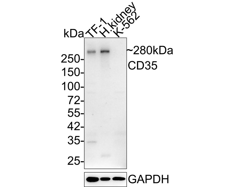 Western blot analysis of CD35 on TF-1 cell lysates with Mouse anti-CD35 antibody (HA601022) at 1/500 dilution.<br />
<br />
Lane 1: TF-1 cell lysate<br />
<br />
Lysates/proteins at 10 µg/Lane.<br />
<br />
Predicted band size: 224 kDa<br />
Observed band size: 300 kDa<br />
<br />
Exposure time: 2 minutes;<br />
<br />
5% SDS-PAGE gel.<br />
<br />
Proteins were transferred to a PVDF membrane and blocked with 5% NFDM/TBST for 1 hour at room temperature. The primary antibody (HA601022) at 1/500 dilution was used in 5% NFDM/TBST at room temperature for 2 hours. Goat Anti-Mouse IgG - HRP Secondary Antibody (HA1006) at 1:20,000 dilution was used for 1 hour at room temperature.