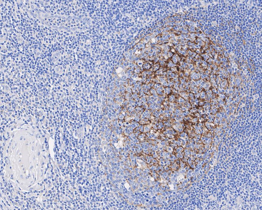 Immunohistochemical analysis of paraffin-embedded human tonsil  tissue with Mouse anti-CD35 antibody (HA601022) at 1/500 dilution.<br />
<br />
The section was pre-treated using heat mediated antigen retrieval with Tris-EDTA buffer (pH 9.0) for 20 minutes. The tissues were blocked in 1% BSA for 20 minutes at room temperature, washed with ddH2O and PBS, and then probed with the primary antibody (HA601022) at 1/500 dilution for 1 hour at room temperature. The detection was performed using an HRP conjugated compact polymer system. DAB was used as the chromogen. Tissues were counterstained with hematoxylin and mounted with DPX.