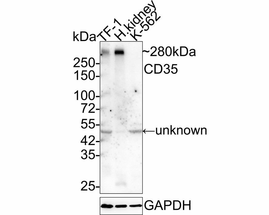 Western blot analysis of CD35 on TF-1 cell lysates with Mouse anti-CD35 antibody (HA601023) at 1/500 dilution.<br />
<br />
Lane 1: TF-1 cell lysate<br />
<br />
Lysates/proteins at 10 µg/Lane.<br />
<br />
Predicted band size: 224 kDa<br />
Observed band size: 300 kDa<br />
<br />
Exposure time: 2 minutes;<br />
<br />
5% SDS-PAGE gel.<br />
<br />
Proteins were transferred to a PVDF membrane and blocked with 5% NFDM/TBST for 1 hour at room temperature. The primary antibody (HA601023) at 1/500 dilution was used in 5% NFDM/TBST at room temperature for 2 hours. Goat Anti-Mouse IgG - HRP Secondary Antibody (HA1006) at 1:20,000 dilution was used for 1 hour at room temperature.