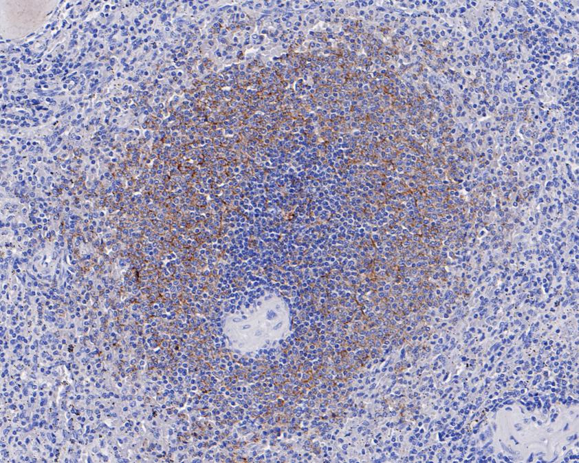 Immunohistochemical analysis of paraffin-embedded human spleen  tissue with Mouse anti-CD35 antibody (HA601023) at 1/500 dilution.<br />
<br />
The section was pre-treated using heat mediated antigen retrieval with Tris-EDTA buffer (pH 9.0) for 20 minutes. The tissues were blocked in 1% BSA for 20 minutes at room temperature, washed with ddH2O and PBS, and then probed with the primary antibody (HA601023) at 1/500 dilution for 1 hour at room temperature. The detection was performed using an HRP conjugated compact polymer system. DAB was used as the chromogen. Tissues were counterstained with hematoxylin and mounted with DPX.